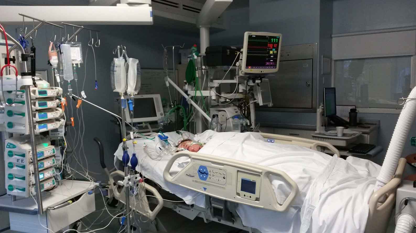 Woman in a hospital bed surrounded my life saving machines 